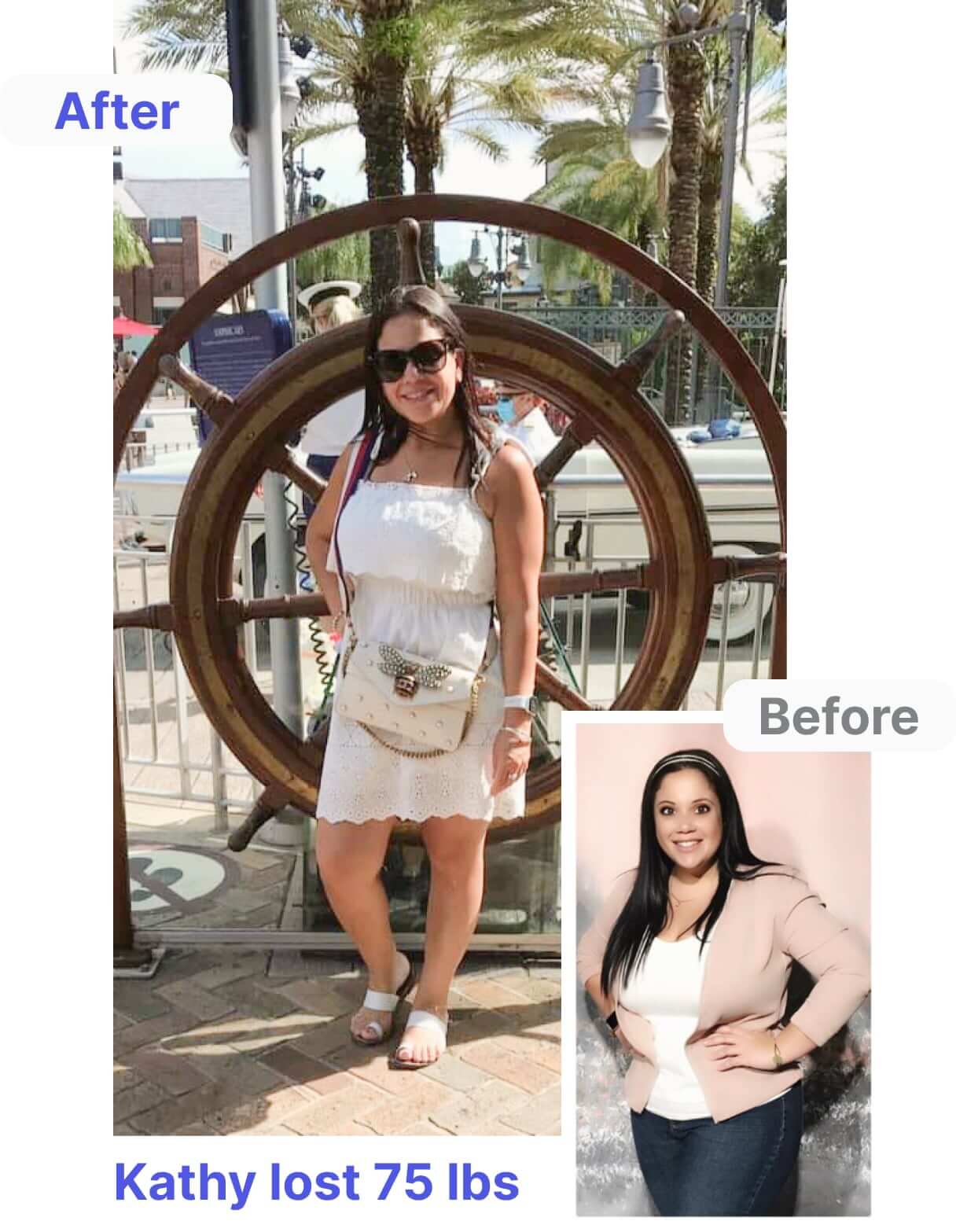 Kathy's Before and After Bariatric Surgery